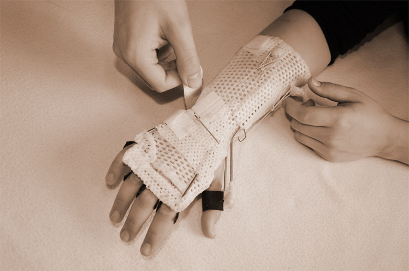 Ergotherapie - Was ist das?